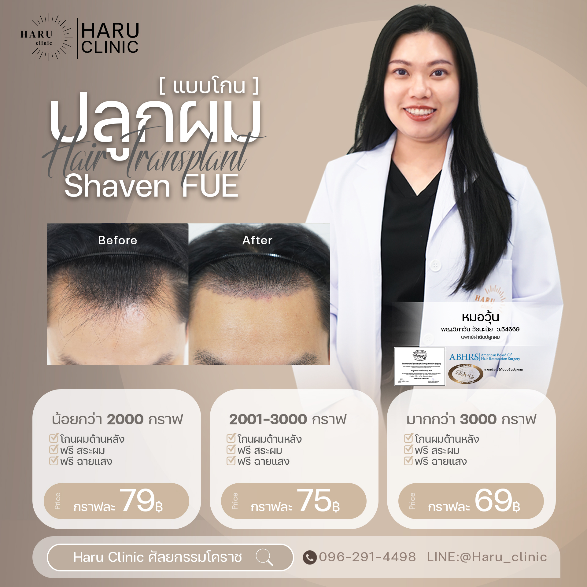 ปลูกผมแบบโกน