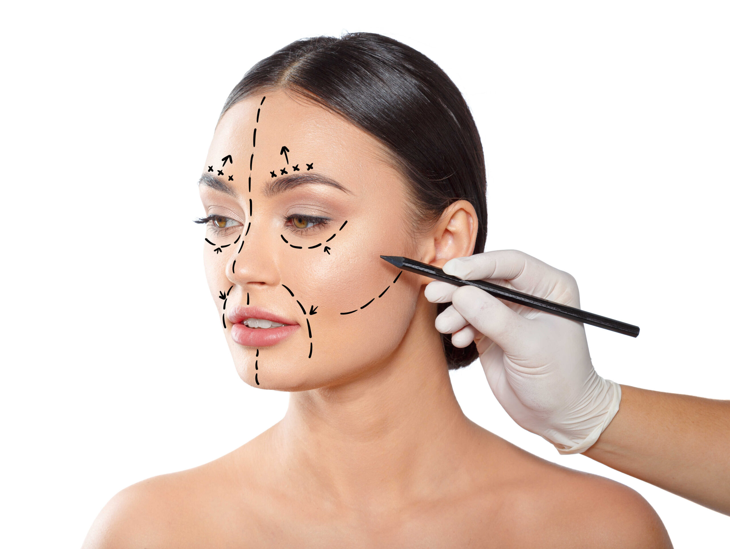 โปรแกรมร้อยไหม (Thread Lift)