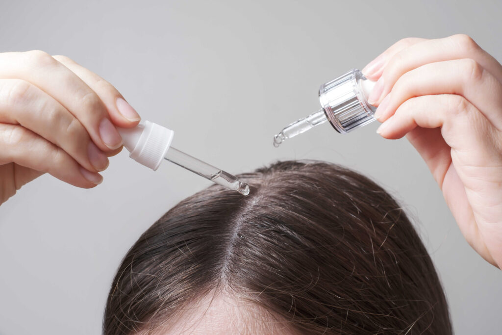 ยา Minoxidil (ไมนอกซิดิล) คืออะไร? ตัวช่วยที่คนผมบางต้องรู้จัก