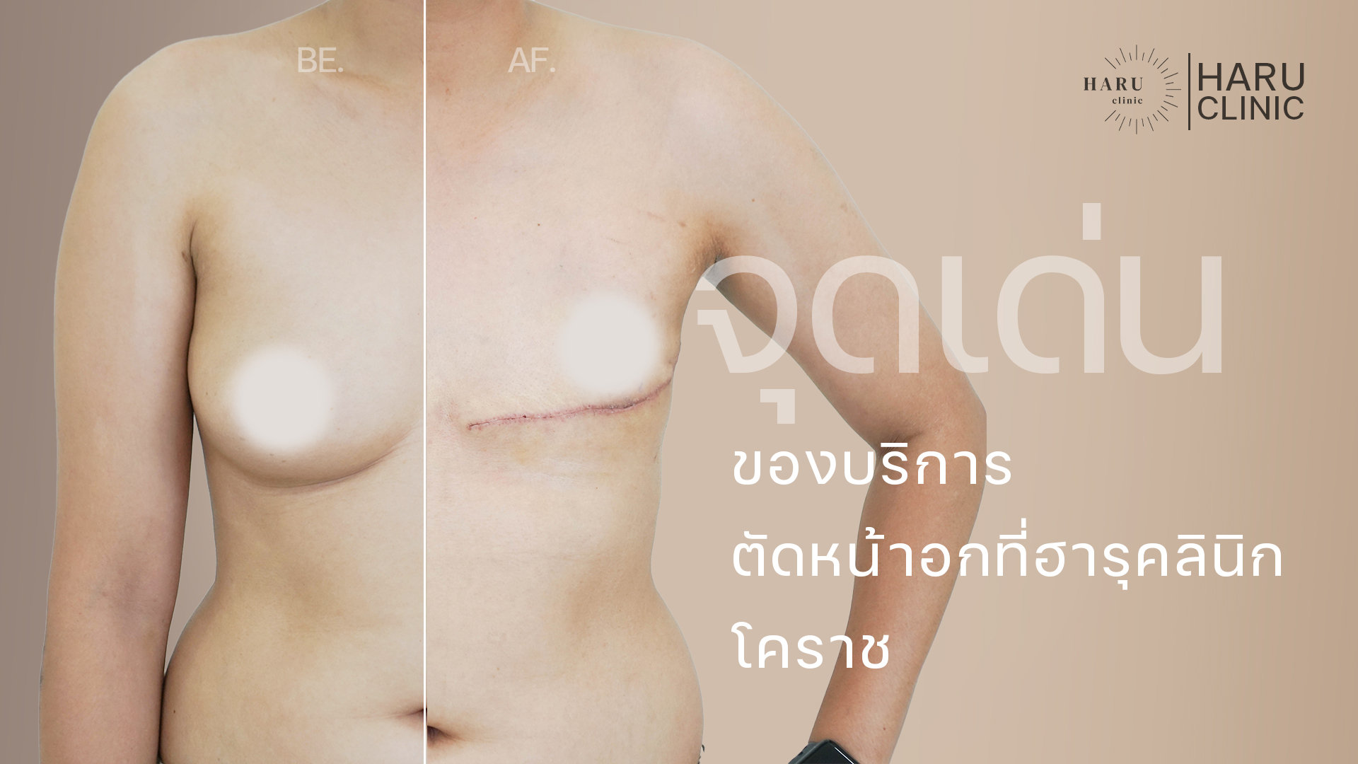 จุดเด่นของบริการนี้ที่ ฮารุคลินิก โคราช